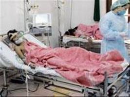 Gripe A (H1N1)