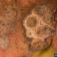 Antracnose