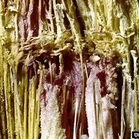 Fusariose