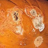 Podridão de raízes