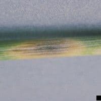 Septoriose da gluma