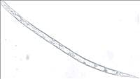Nematoide-das-galhas