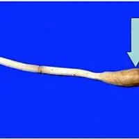 Meloidoginose