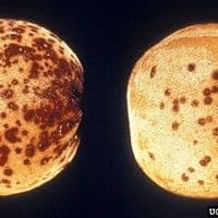 Mancha bacteriana