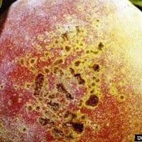 Mancha bacteriana
