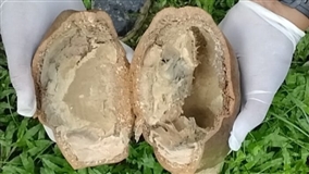 Acre investiga suspeita de monilíase