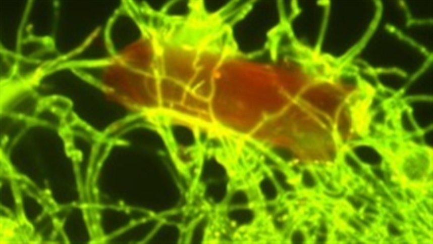 Imagem de P. album em microscopia de fluorescência corada com laranja de acridina e visualizadas com ampliação de 100 X.