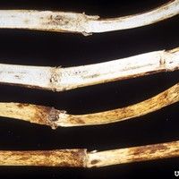 Antracnose